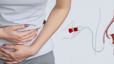 Photo of Miyom Embolizasyonu Nedir?