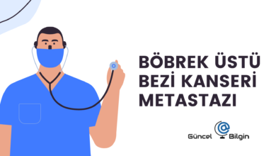 Photo of Böbrek Üstü Bezi Kanseri Metastazı
