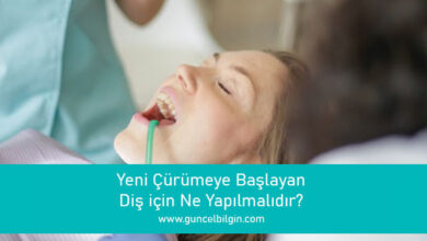 Photo of Yeni Çürümeye Başlayan Diş için Ne Yapılmalıdır?