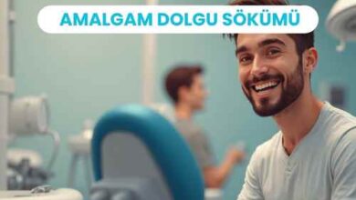 Photo of Amalgam Dolgu Sökümü: 2025 Güncel Kapsamlı Rehber ve SMART Protokolü