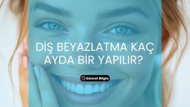 Photo of Diş Beyazlatma Kaç Ayda Bir Yapılır?