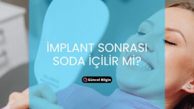 Photo of İmplant Sonrası Soda İçilir Mi? Detaylı Rehber