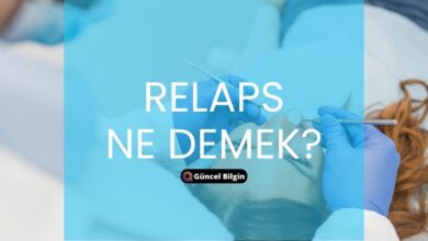 Photo of Relaps Ne Demek? Nüksetme Hakkında Bilmeniz Gereken Her Şey