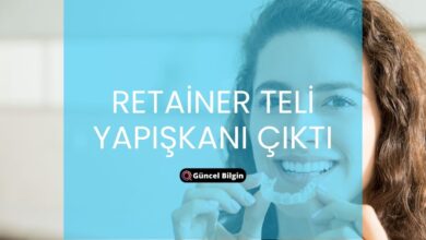 Photo of Retainer Teli Yapışkanı Çıktı Ne Yapmalıyım? Çözüm Rehberi