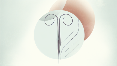 Photo of İki Sezaryen: Aynı Kesinin Doğum Hikayesindeki Rolü Nedir?